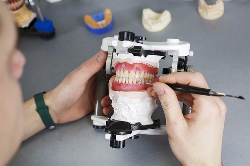 modelowanie protezy ortodontycznej